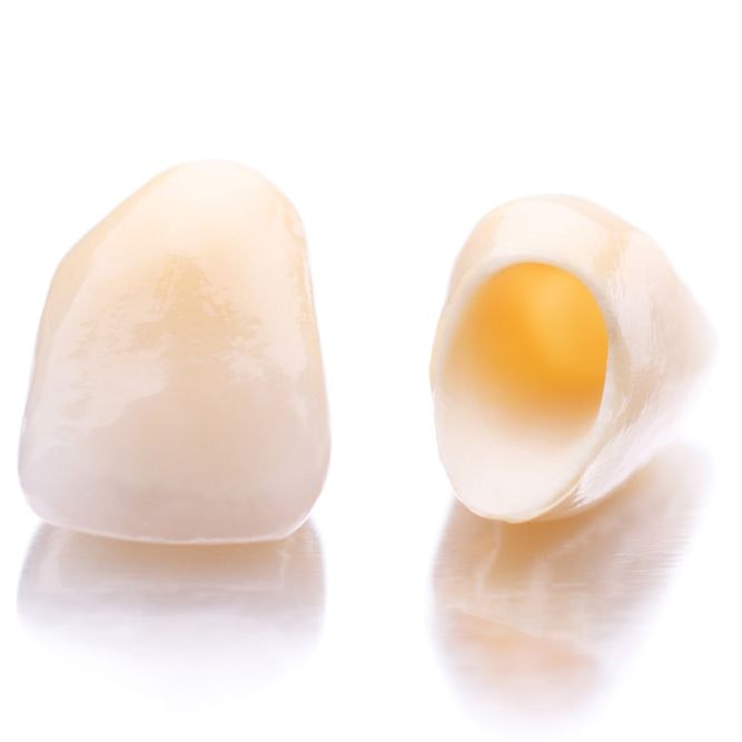 dental crown model