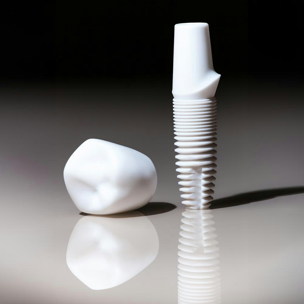 dental implant model