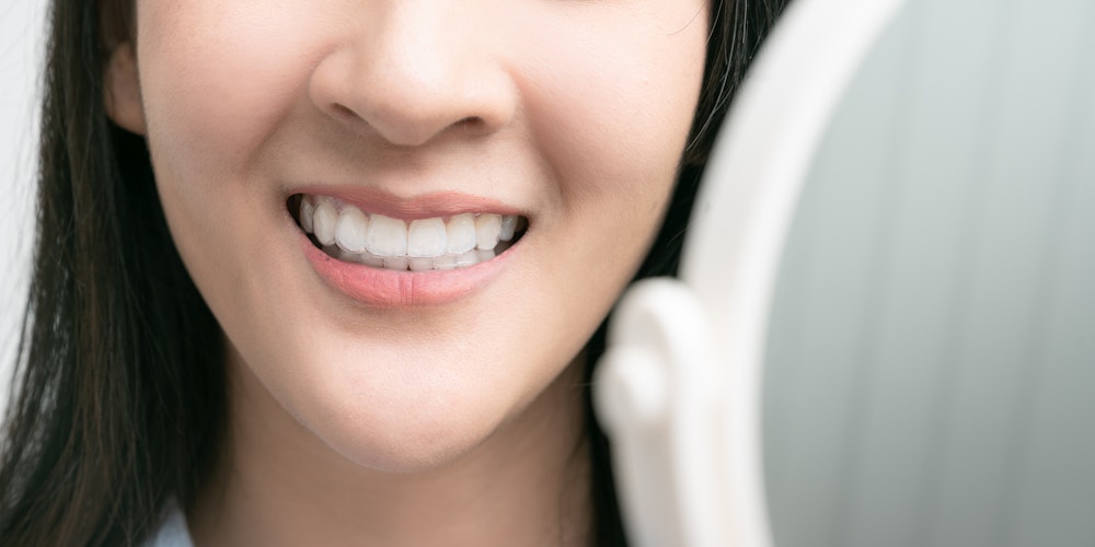Woman wearing invisalign looking in the mirror