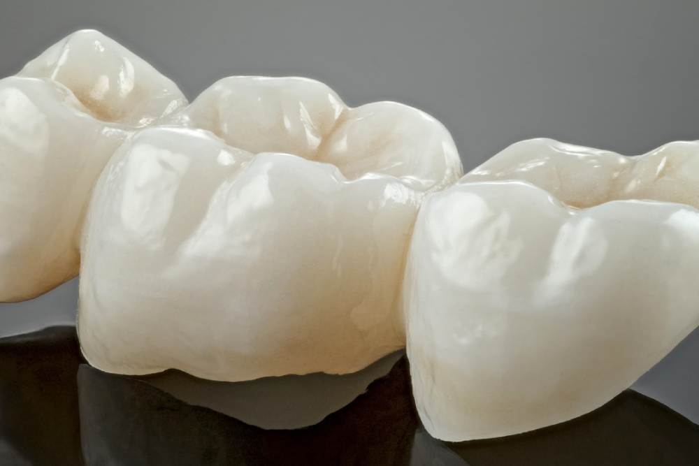 How Dental Crowns Help Prevent Tooth Loss After a Root Canal